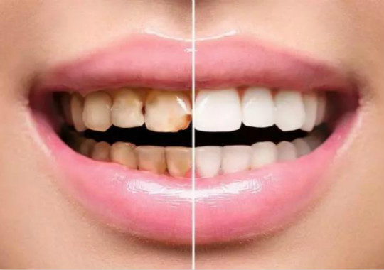 <b>美白牙膏真的可以美白吗？牙齿发黄怎么美白靠谱？</b>