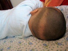 <b>孩子枕秃是病吗？真的要补钙吗？</b>