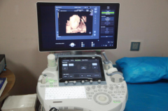 港龙妇产医院引入首台GE-E8四维提高胎儿超声诊断精确性
