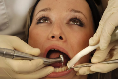 补牙防坑攻略丨各种补牙材料对牙齿影响