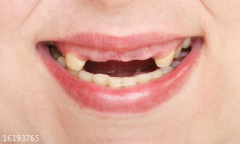 种植牙到底是怎么种上的？来看名医5H全息技术种牙过程！