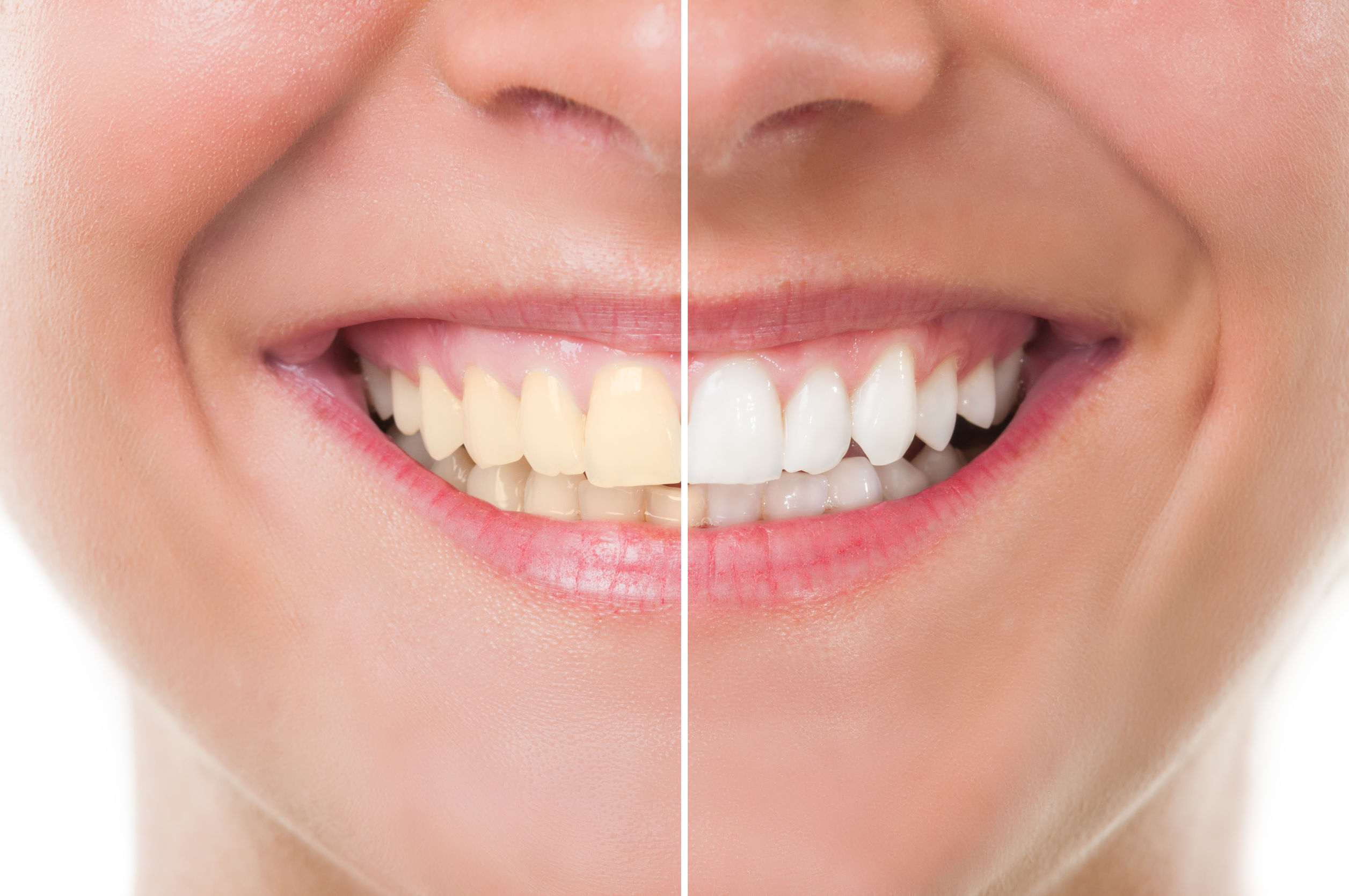 <b>这5个美白牙齿的简单办法，医生说这个更有效！</b>