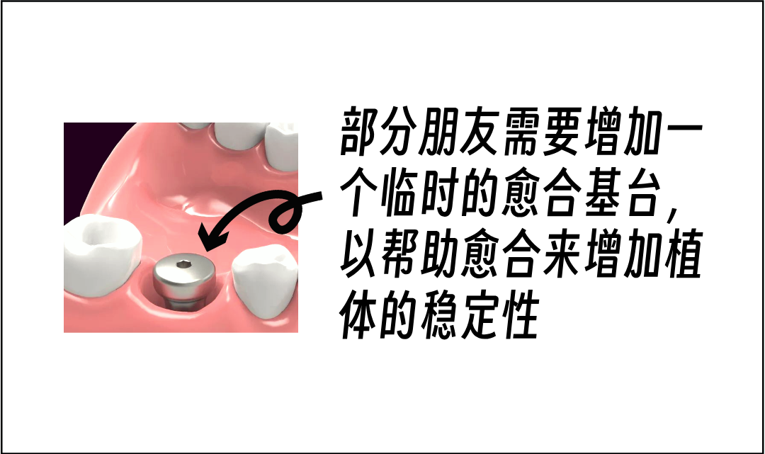种牙5.12__2025-04-18+11_30_01.png