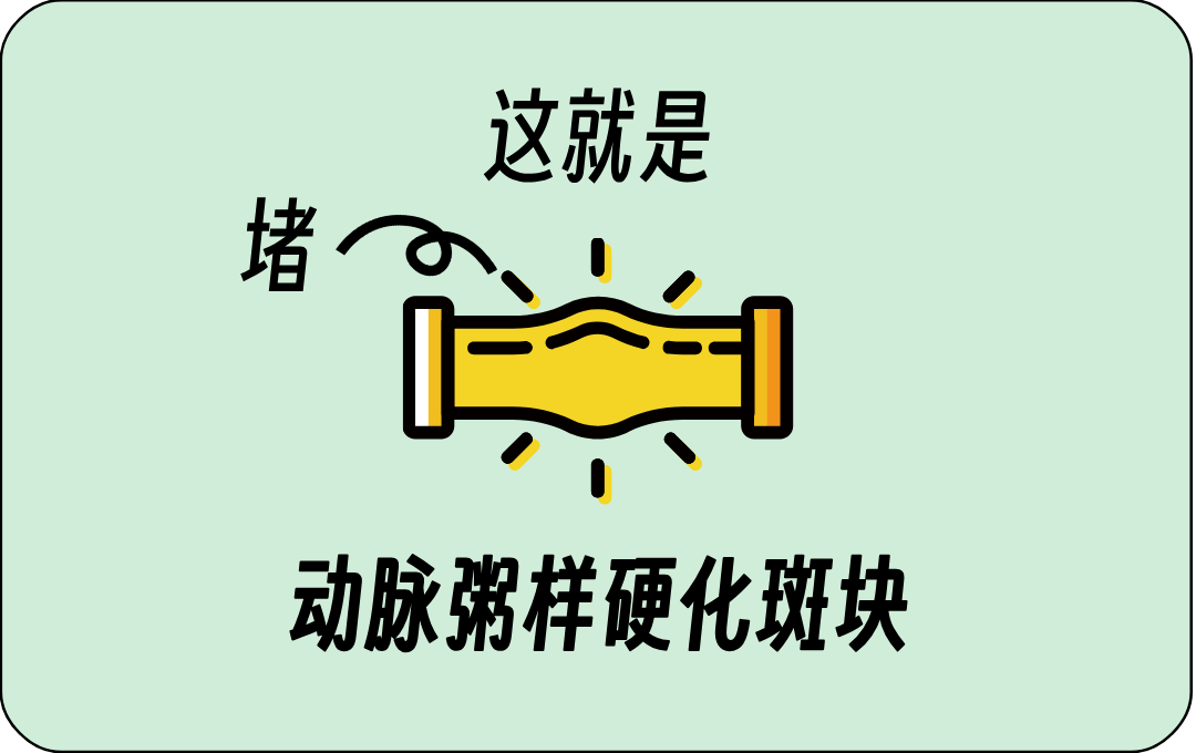 血管狭窄__2025-04-23+11_33_10.png