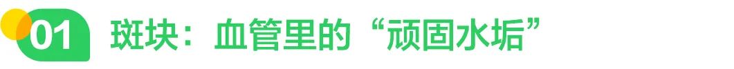 斑块：血管里的“顽固水垢”.jpg