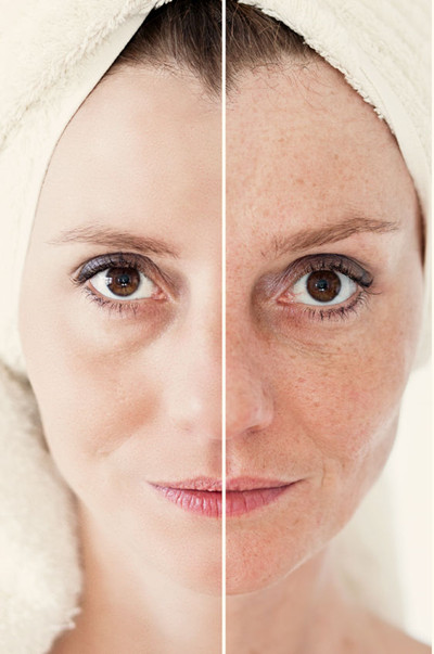 抑制皱纹和老年斑的出现,保持脸部和头发光泽,所缺钙容易使脸上长色斑